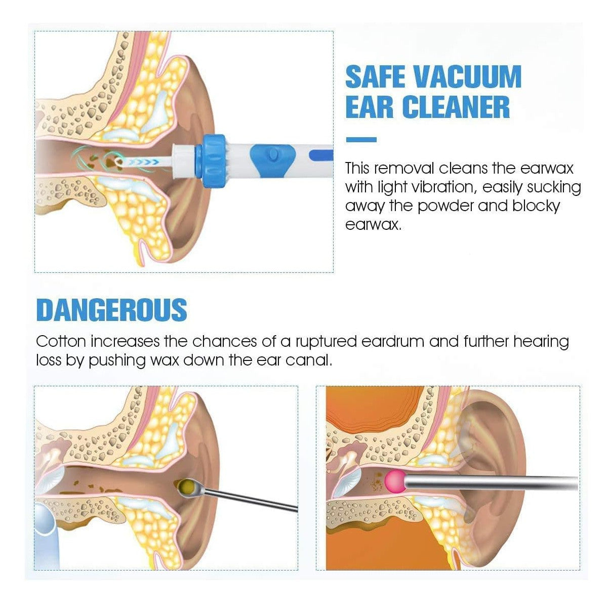Limpiador De Oidos Electrico Remove cera