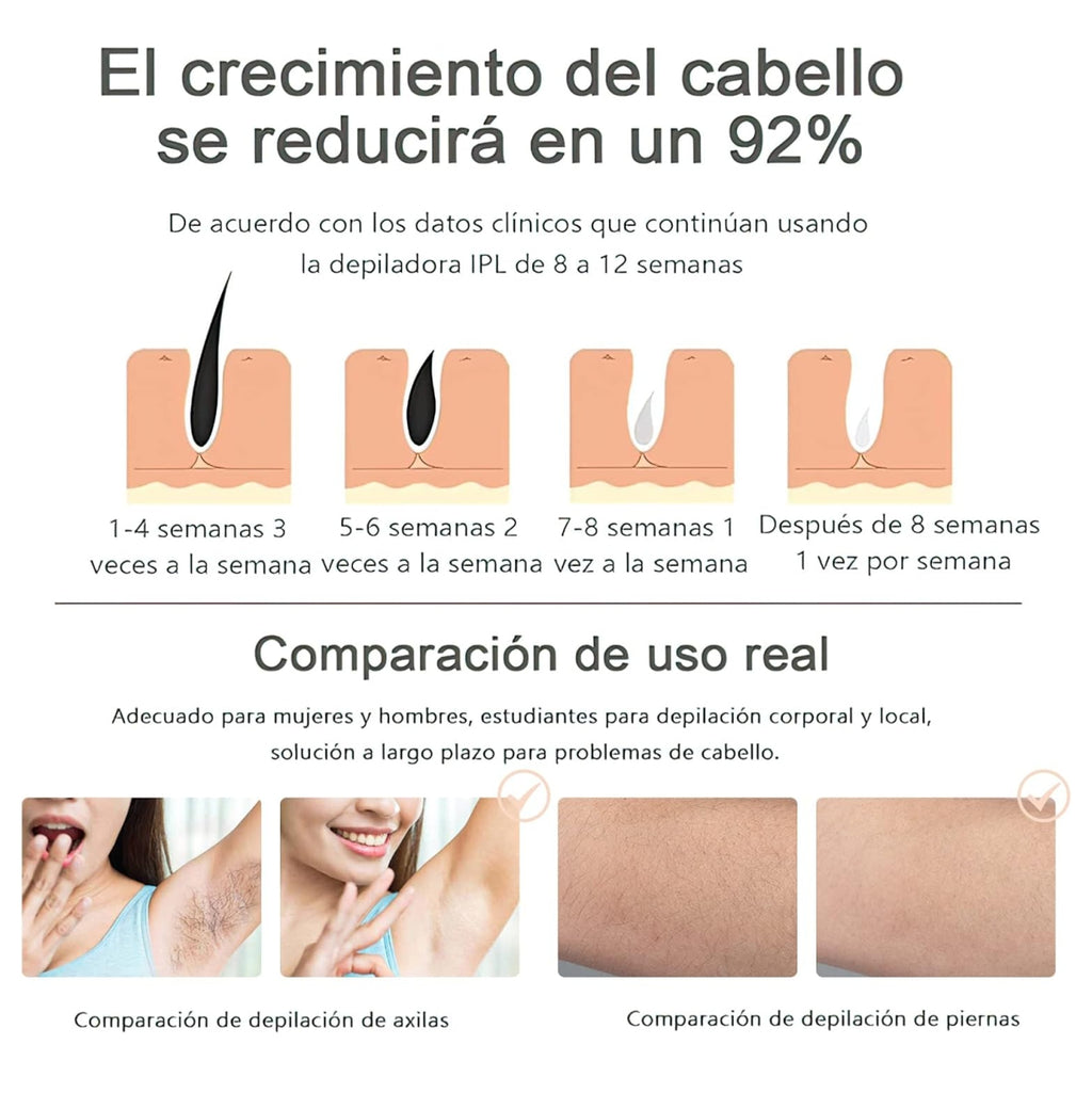 Depiladora IPL Laser eléctrica Profesion